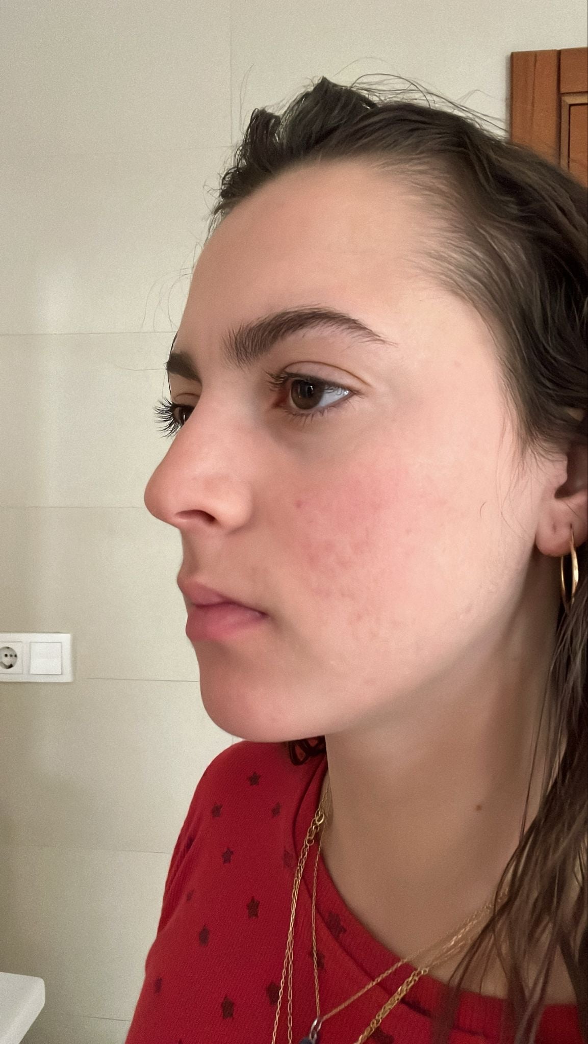 difumina marcas de acné