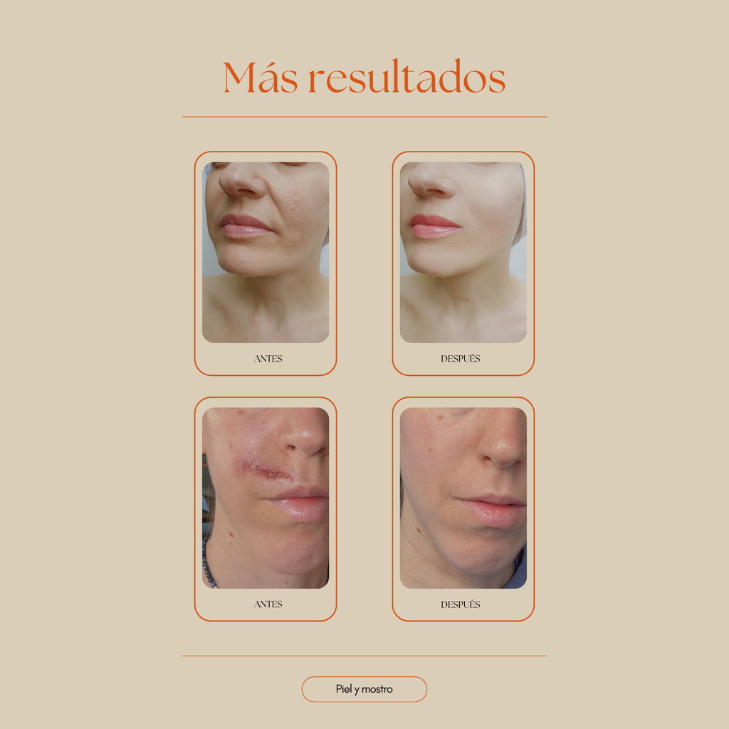 Elixir Ancestral - fórmula ayurvédica para pieles que ya lo han probado todo