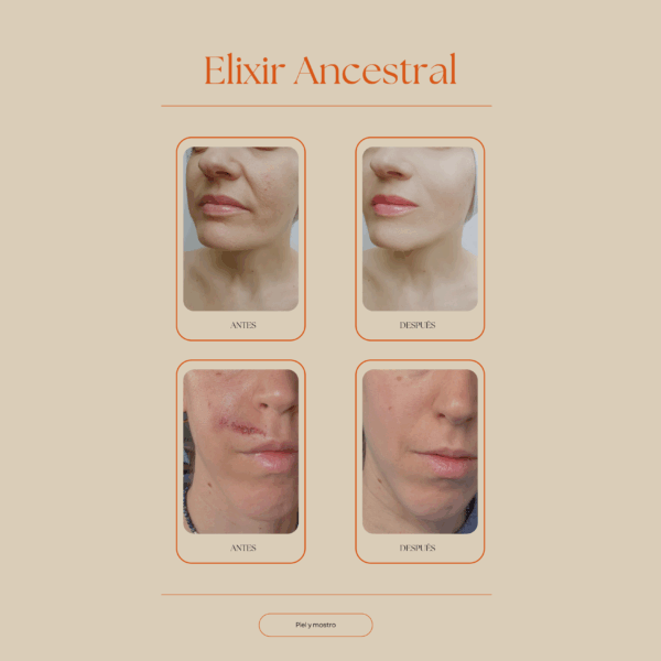 elixir ancestral antes y después elimina cicatrices y manchas sana la piel ilumina y rejuvenece Set Ritual de Belleza Ancestral